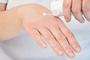 چند راهکار طبیعی برای درمان خشکی پوست دست