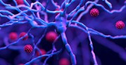تغییرات شبیه آلزایمر در مغز بیماران کرونا دیده می‌شود
