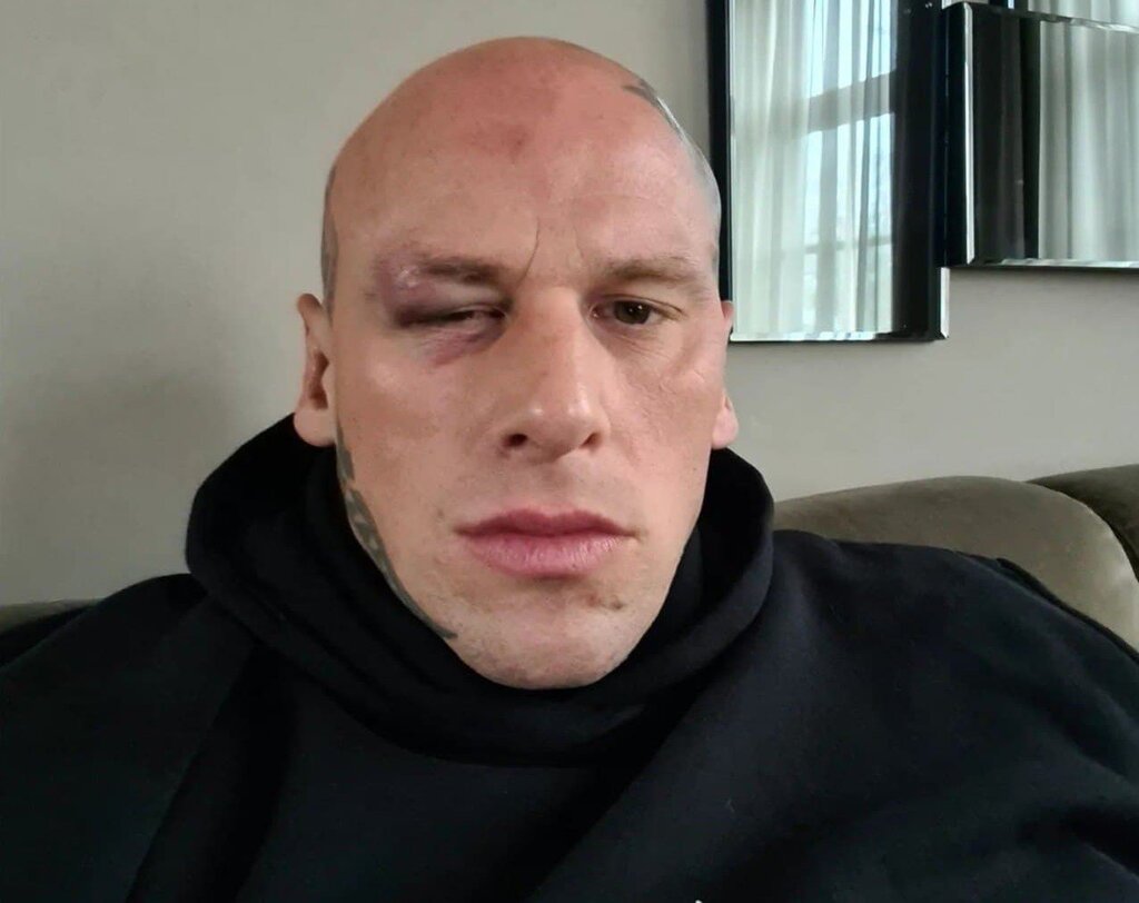 عکس | کری خوانی ترسناک ترین مرد جهان برای سجاد غریبی | به این زخم ها نگاه کن؛ جای تو فعلا امن است!