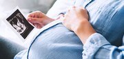توصیه های یک متخصص؛ این دو کار را در دوران بارداری انجام ندهید | روش‌های زیباسازی پوست در دوران بارداری!