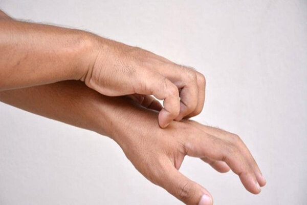 این ۴ تغییر پوستی نشان میدهد کبد بیماری دارید