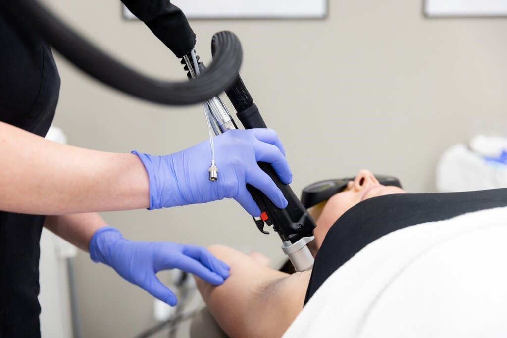 چطور درد لیزر موهای زائد را کمتر کنیم؟