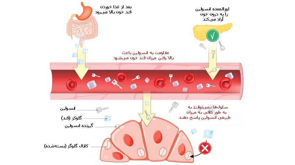 «مقاومت به انسولین» و دچار شدن به دیابت