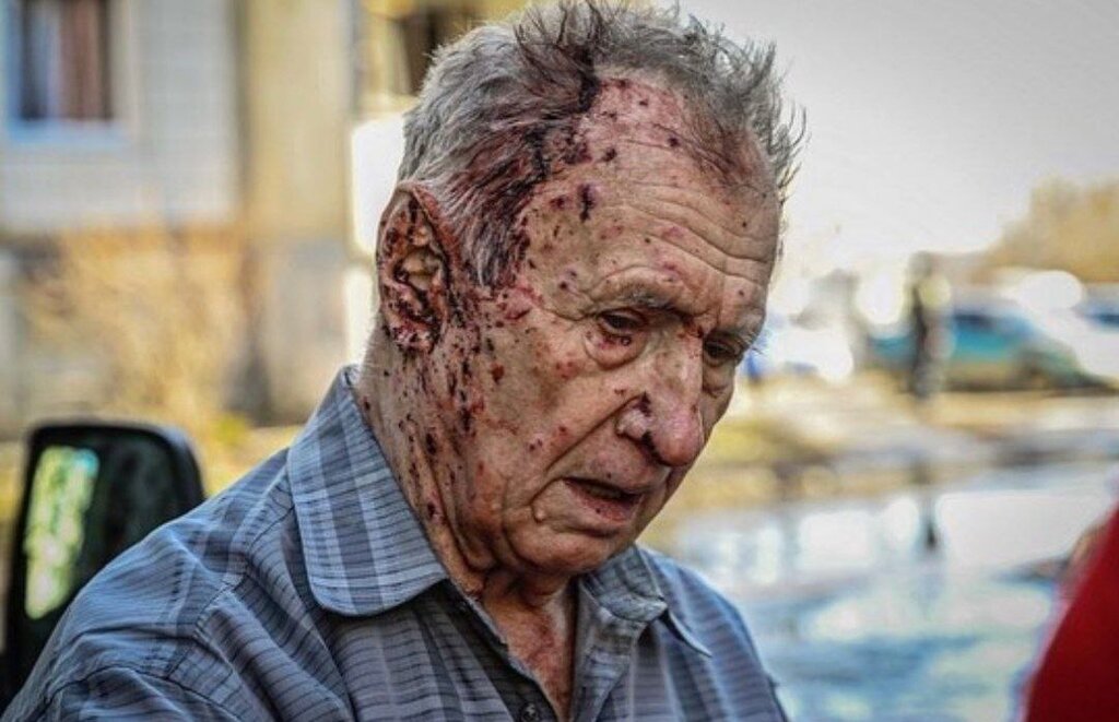 یکی از مجروحان حملات روسیه به اوکراین