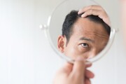 مصرف زیاد این ویتامین ریزش مو را تشدید می‌کند | ریزش موی طبیعی چقدر است