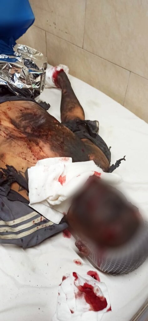 تصاویر دلخراش از مصدومیت ۳ نفر بر اثر انفجار مواد محترقه