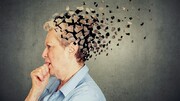 یائسگی زودرس ممکن است خطر آلزایمر را در زنان بالا ببرد