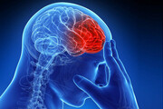 تاثیرات کرونا بر مغز انسان | آیا تغییرات ایجاد شده دائمی هستند؟