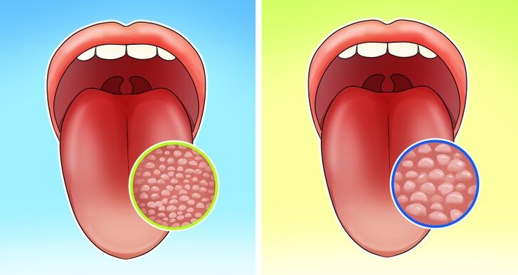 ویژگیهای بدنی عجیبی که فقط بعضیهایمان آنها را داریم