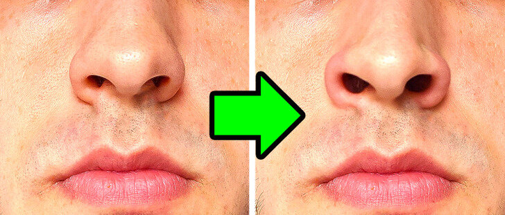 ویژگیهای بدنی عجیبی که فقط بعضیهایمان آنها را داریم