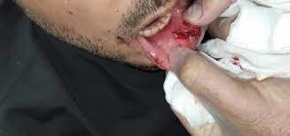 روایت تلخ ضرب و شتم یک پزشک | ضارب چرا به این پزشک حمله کرد؟