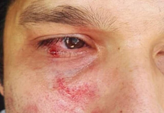 روایت تلخ ضرب و شتم یک پزشک | ضارب چرا به این پزشک حمله کرد؟