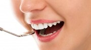 کمبود این ویتامین‌ها باعث پوسیدگی دندان می‌شود | به چه خوراکی‌هایی لب نزنیم؟