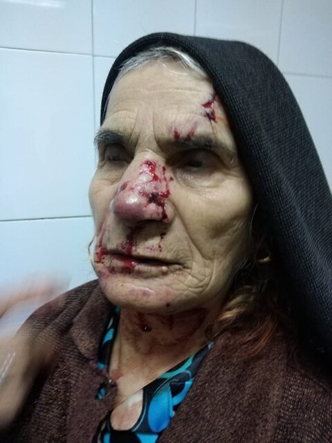 تصویر | حمله گرگهای گرسنه به دو زن در خلخال