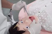 ببینید | اختراع جدید دانشمندان ژاپنی برای دندان‌پزشکی اطفال!