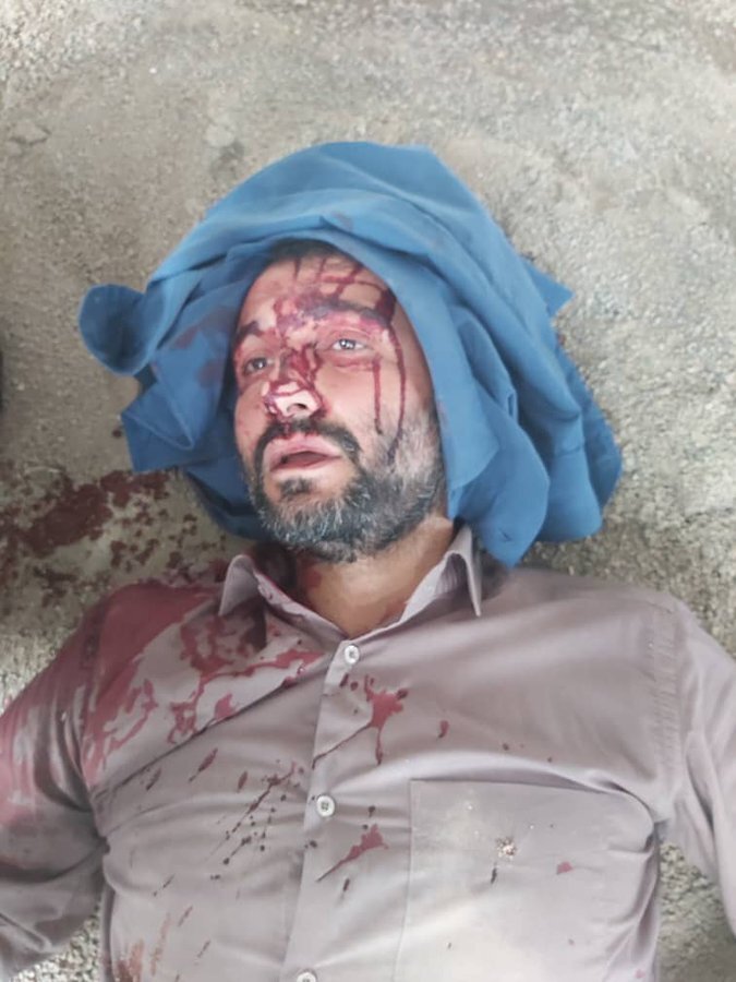 حمله با چاقو به شهردار ناحیه ۳ منطقه ۱۹ در هنگام ماموریت