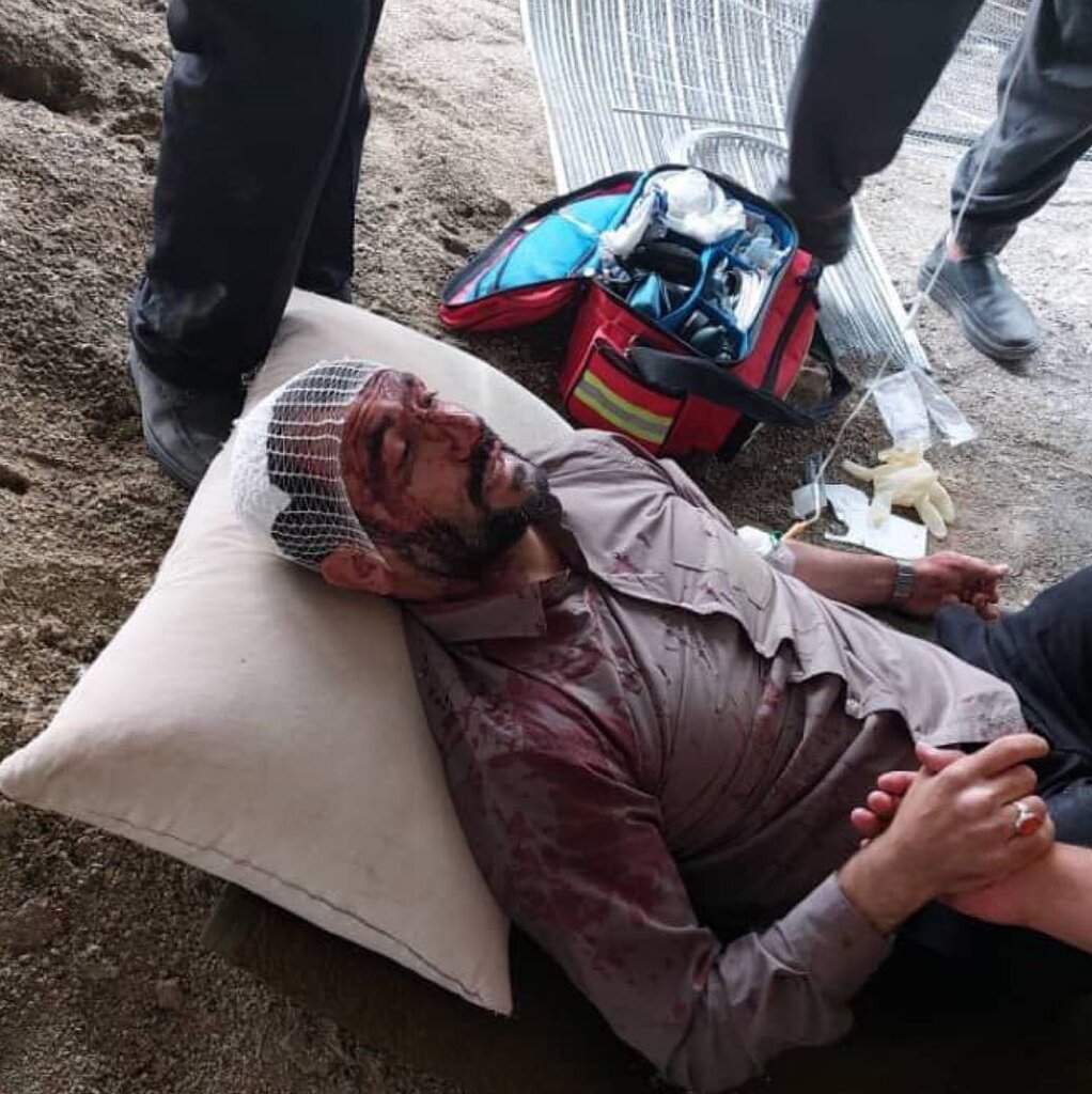 تصویر خونین یک شهردار پس از حمله افراد ناشناس با چاقو | دست مافیای ساخت و ساز در کار است؟ | توضیحات شهردار منطقه