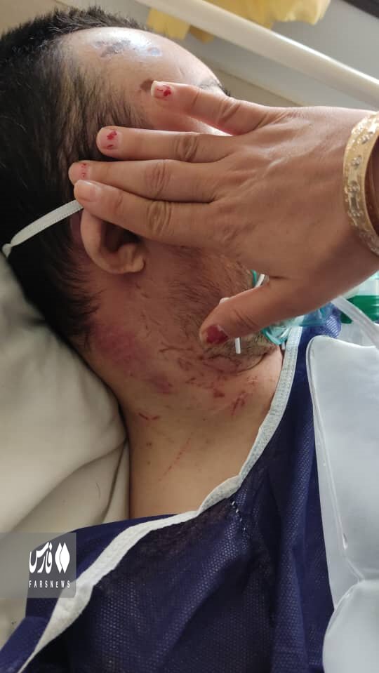 عکس | ضرب و جرح شدید یک معلول سندروم داون | میگویند «خودزنی» کرده است! | دادستانی به قضیه ورود کند