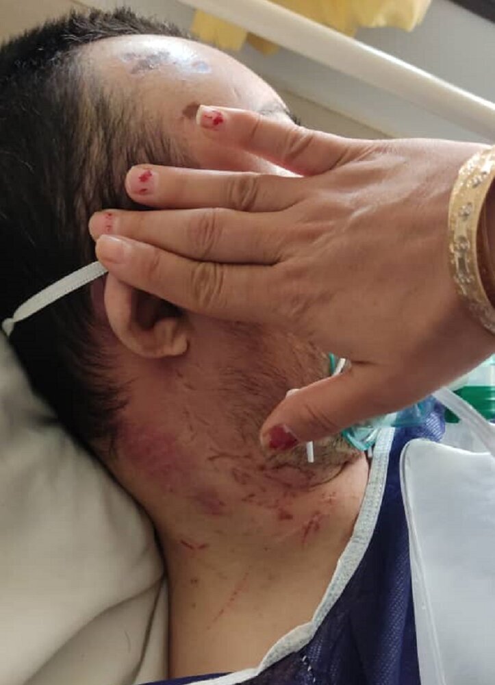 شوک شدید ضرب و شتم بیمار سندروم داون در سمنان | خودزنی تکذیب شد؛ مسئولان بالاخره تایید کردند ضرب و شتم معلول