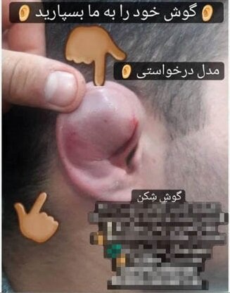 چند میگیری گوش بشکنی؟ | شکستن گوش ۴۵۰ هزار تومان ناقابل | مدلهای گل کلمی و حلزونی بالای یک میلیون تومان