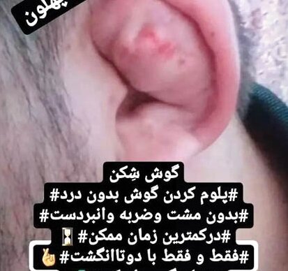 چند میگیری گوش بشکنی؟ | شکستن گوش ۴۵۰ هزار تومان ناقابل | مدلهای گل کلمی و حلزونی بالای یک میلیون تومان