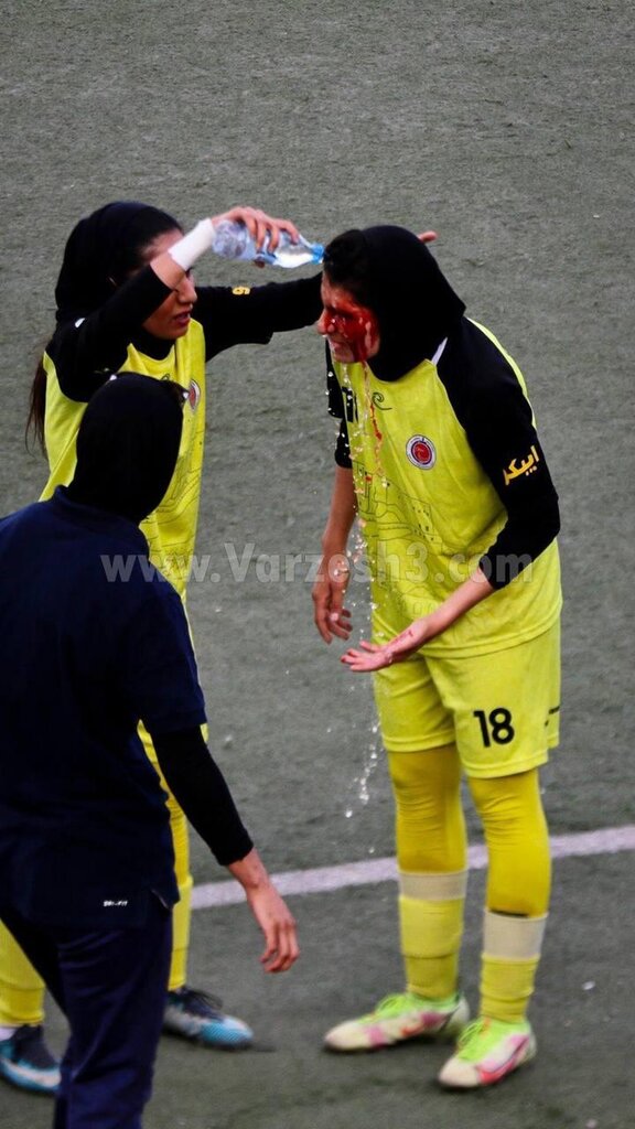 عکس | تصویری وحشتناک از فوتبال زنان در ایران | صورت خونین و جراحی وسط بازی