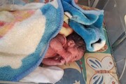 سرنوشت نوزاد رها شده در سطل زباله نازی‌آباد | وضعیت ورم پشت سر نوزاد