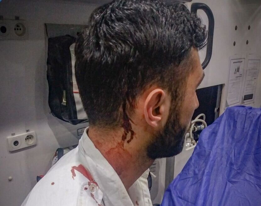 عکس | به کارشناس اورژانس موقع کمک به مصدوم چاقو زدند