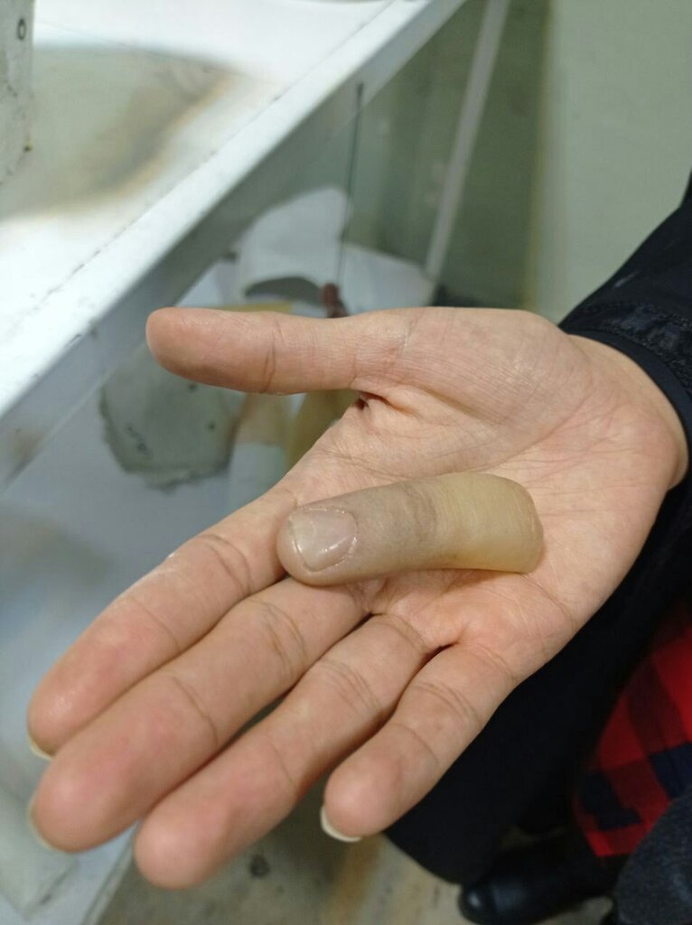 تصاویر | اینجا کارخانه انگشت سازی در تبریز است | حادثه تلخی که مسیر زندگی این جوان ایرانی را تغییر داد