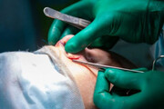 مرگ زن جوان زیر تیغ جراح زیبایی | مسئولان کلینیک: مینو هنگام عمل بینی سکته قلبی کرد