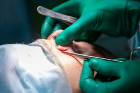 جراح زیبایی اینستاگرامی باعث طلاق چندین زن شد! | ماجرای جراحی بینی بدون بیهوشی توسط دستیار دیپلمه