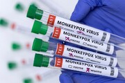 تصمیم‌گیری سازمان جهانی بهداشت درباره وضعیت اضطراری آبله میمونی| نام آبله میمونی تغییر می‌کند