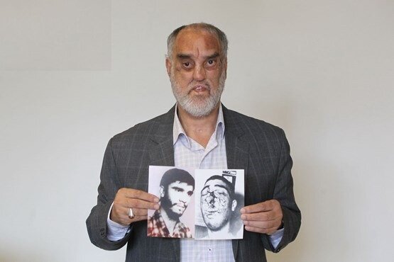 گفتوگو با جانبازی که ۶۰ بار شهید شده است | دخترم پول میداد تا به من نخندند