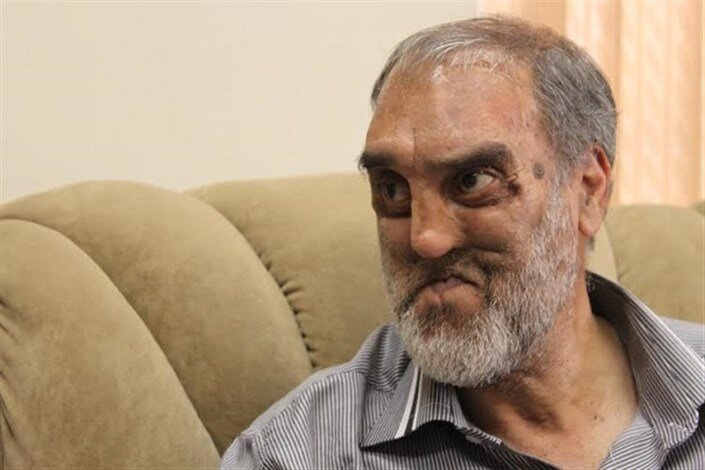 گفتوگو با جانبازی که ۶۰ بار شهید شده است | دخترم پول میداد تا به من نخندند