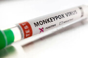 آبله میمونی به جنوب شرق آسیا رسید | کره جنوبی نخستین مورد بیماری را گزارش کرد