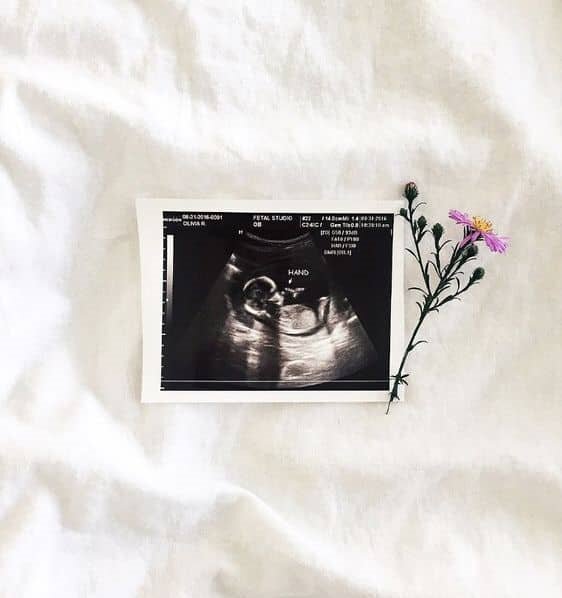 تعیین جــنسیت به شرط چاقو! | جــنس خواستنی؛ از ۲۵ میلیون تومان