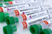 سازمان جهانی بهداشت: مواد آبله میمونی در یک هفته ۷۷ درصد افزایش یافته است