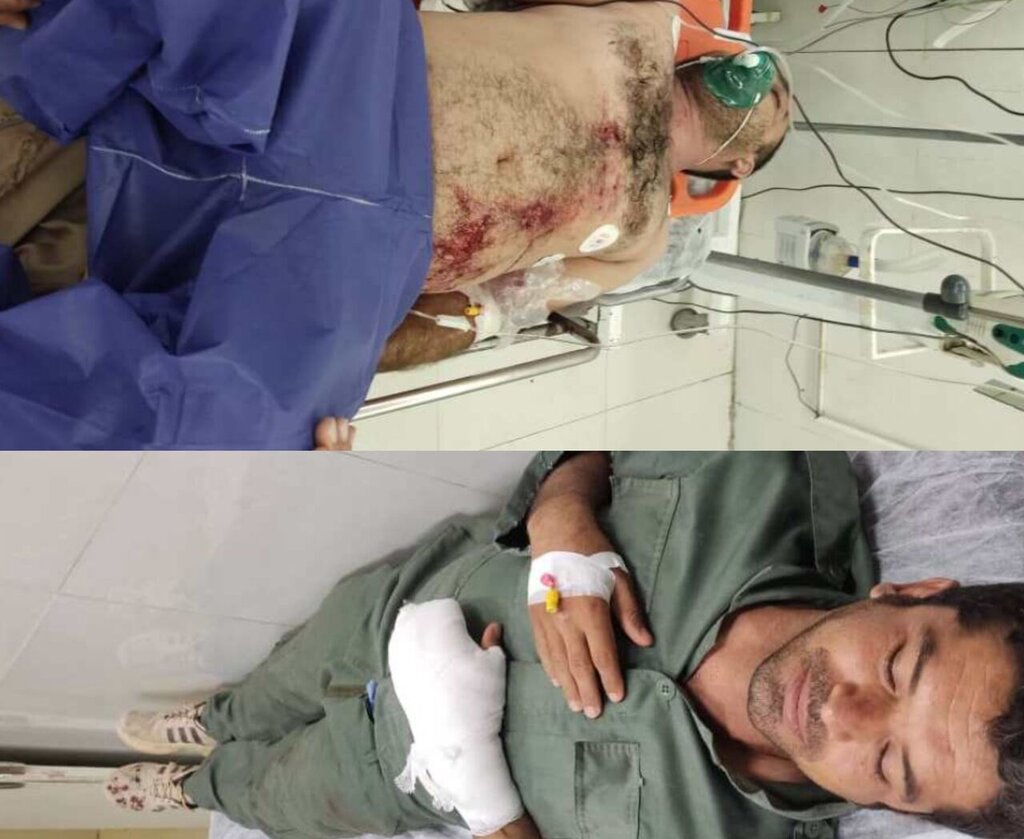 عکس | تیراندازی شکارچیان به ۲ محیطبان بوشهری | حال یکی از محیطبانها وخیم است شلیک به محیطبانان بوشهری