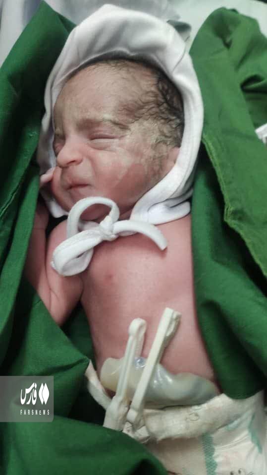 تصویر ۴ قلوهای مادر جوان زنجانی؛ یک دختر و سه پسر | در پارکینگ زندگی میکنیم؛ شیرخشک نیست | درخواست پدر و مادر از رهبر انقلاب و رئیس جمهور