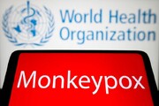 گزارش ۱۴۰۰۰ مورد آبله میمونی در جهان | ۵ مرگ در آفریقا
