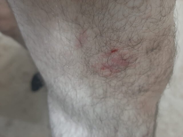 تصاویر | حمله سگهای خانگی به مامور اورژانس تهران | همراه بیمار در خانه را بست و ...