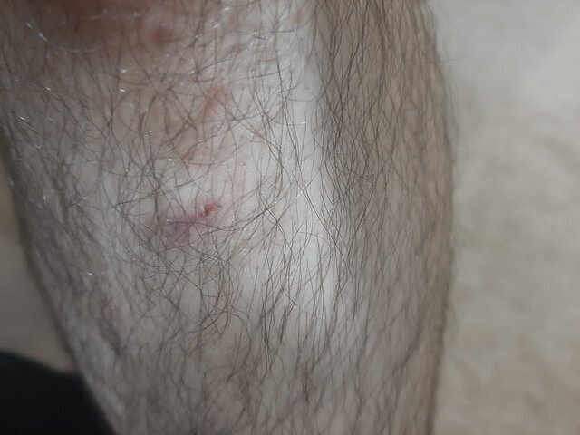 تصاویر | حمله سگهای خانگی به مامور اورژانس تهران | همراه بیمار در خانه را بست و ...