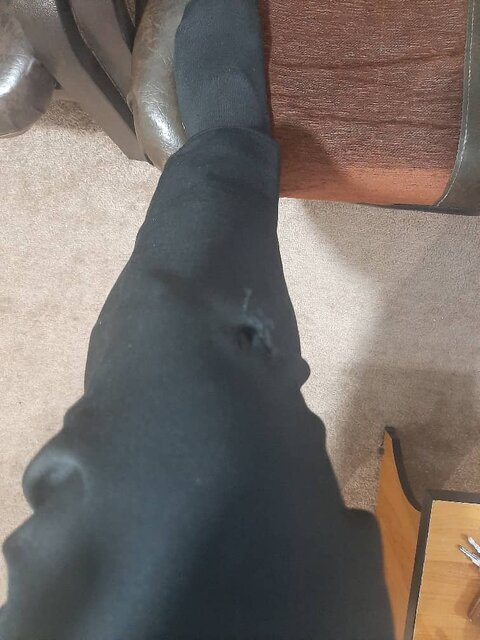 تصاویر | حمله سگهای خانگی به مامور اورژانس تهران | همراه بیمار در خانه را بست و ...