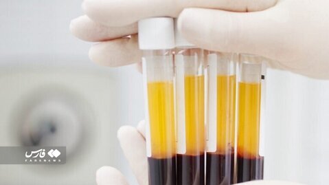 مأموریت عروس و داماد در مرکز اهدای پلاسما چه بود؟ | ۳۰۲ نوبت اهدا برای پرداخت بدهی!