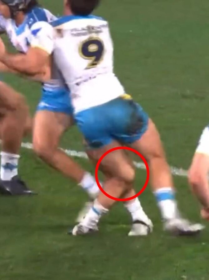 عکس | مصدومیت وحشتناک و دلخراش | اتفاق ناراحتکننده برای ورزشکار استرالیایی