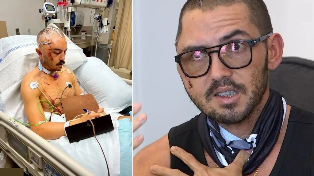 تصاویر تکاندهنده ؛ تمساح جمجمه یک شناگر را له کرد