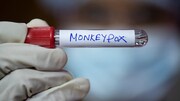 مکزیک و کوبا در رویدادی نادر موارد مرگ ناشی از آبله میمونی را گزارش کردند