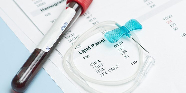 نشانههای رایج چربی خون بالا | برای کلسترول بالا چه بخوریم؟