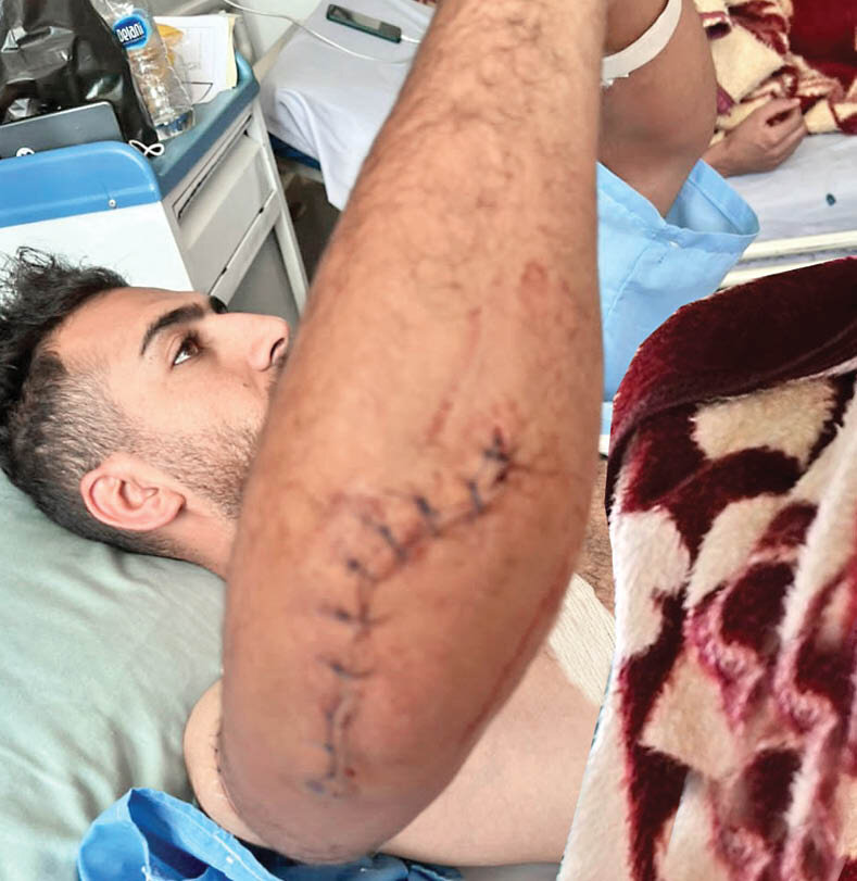 حمله وحشیانه ۶ مرد نقابدار به ویلایی در کردان | یک شاهد عینی:  درحالی‌که به‌شدت زخمی بودم مرا به حیاط و نزد بقیه بردند و همه ما را گروگان گرفتند