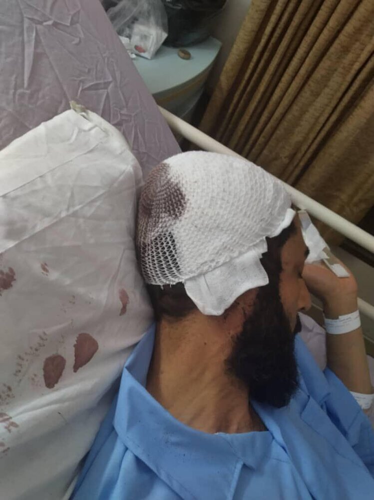 تصاویر | حمله به ۲ روحانی در قم با لوله آهنی | به قصد کشت ما را زدند